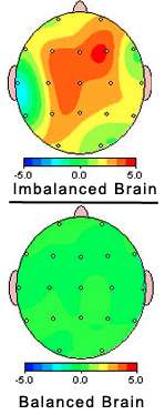 imbalanced brain and balanced brain